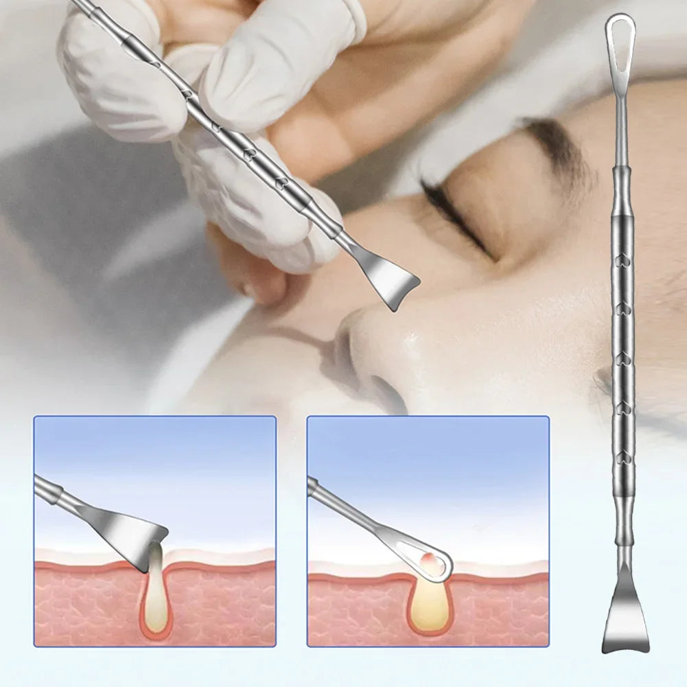 ZapNose Pro - Professional Deep Pore Cleansing Tool